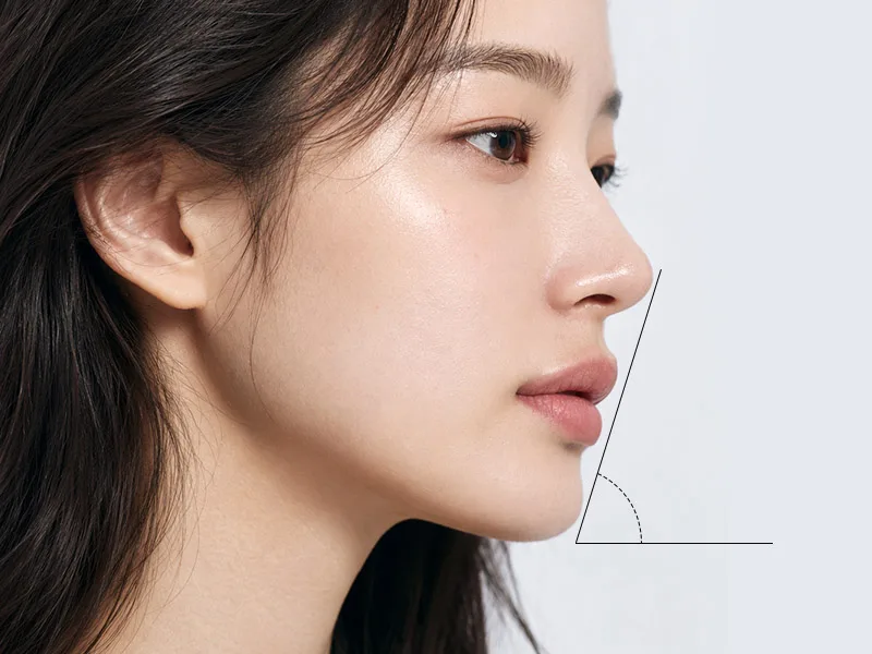 턱끝보형물
