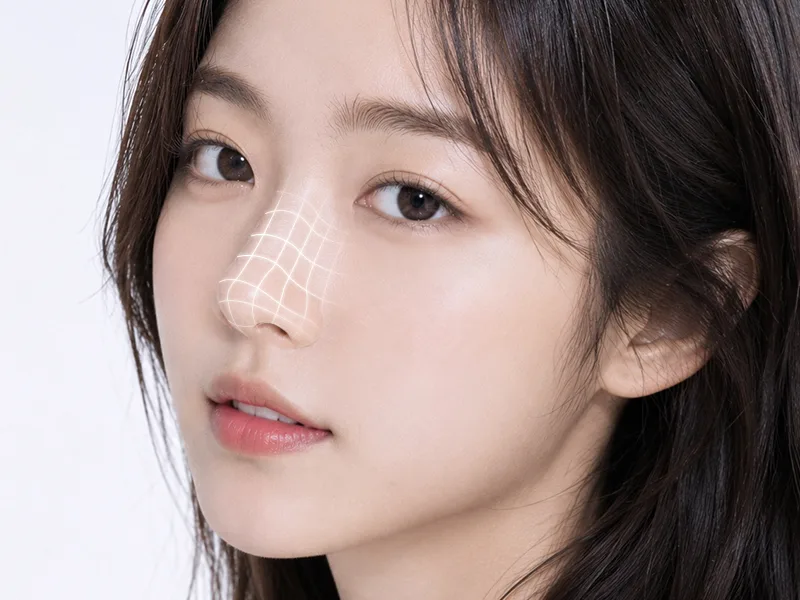 기증진피 이식