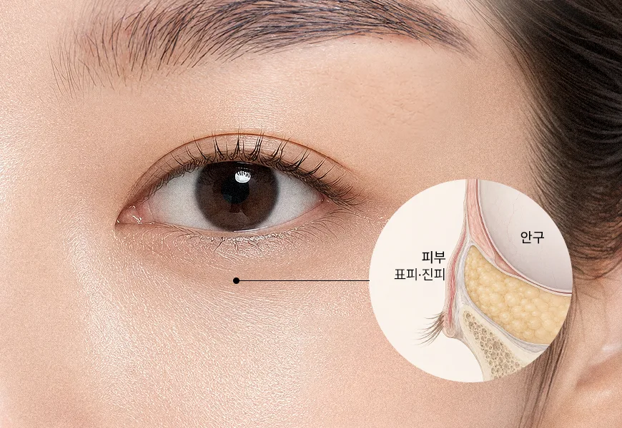Cross-section of the eye area skin layers — the thinnest skin