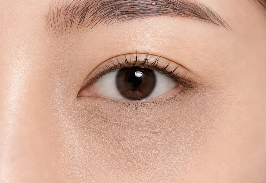 Causes of eye-area dryness and fine lines