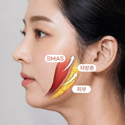 안면거상 과정