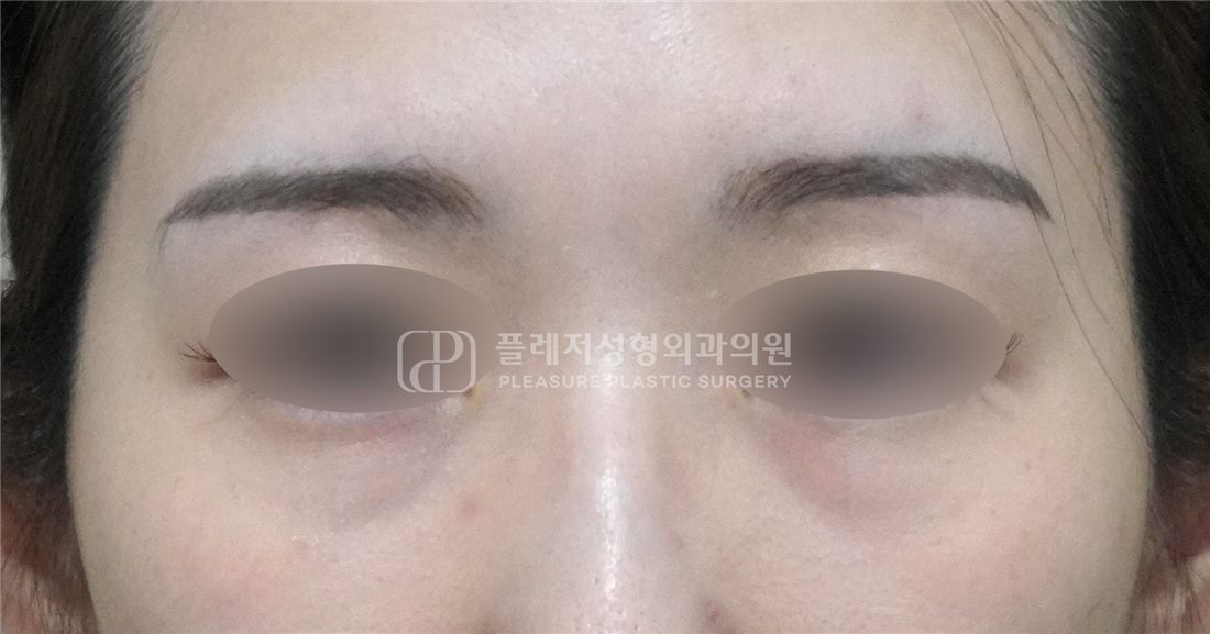 Case 05 Before