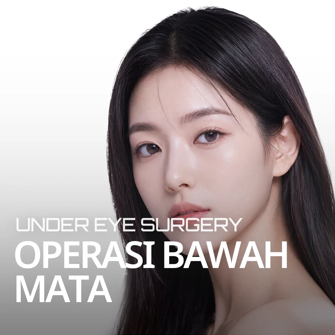 OPERASI BAWAH MATA UNDER EYE SURGERY — banner model yang menonjolkan garis bawah mata