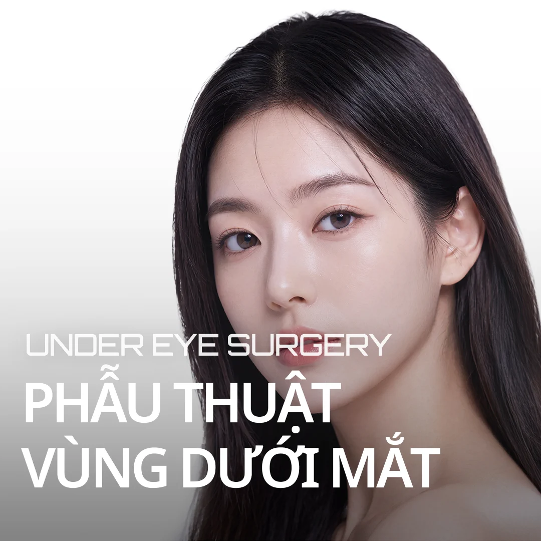 PHẪU THUẬT VÙNG DƯỚI MẮT UNDER EYE SURGERY — banner người mẫu nhấn mạnh đường nét vùng dưới mắt