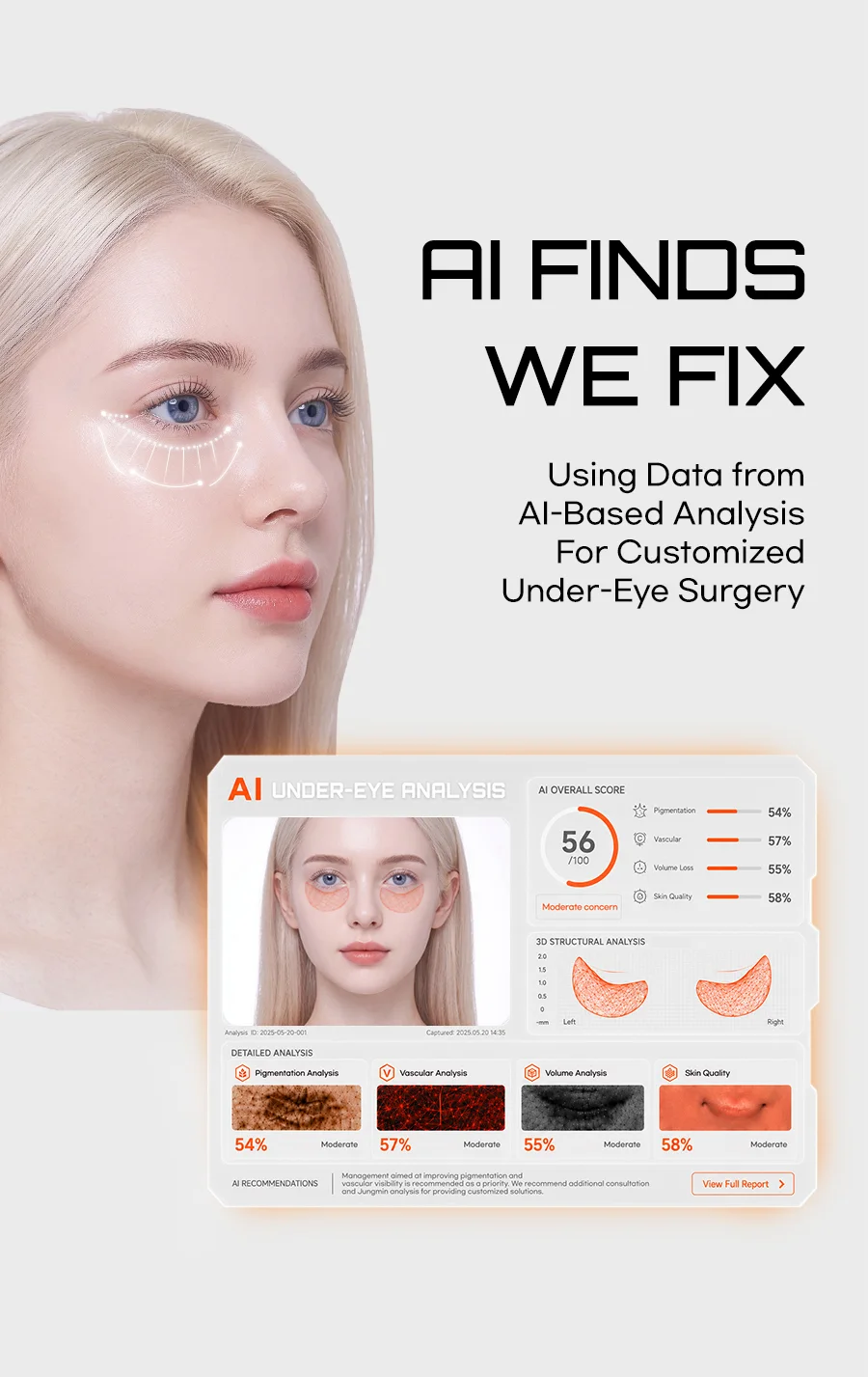 Using Data from AI-Based Analysis For Customized Under-Eye Surgery — AI FINDS. WE FIX. AI under-eye analysis report (Pigmentation 54%, Vascular 57%, Volume Loss 55%, Skin Quality 58%)