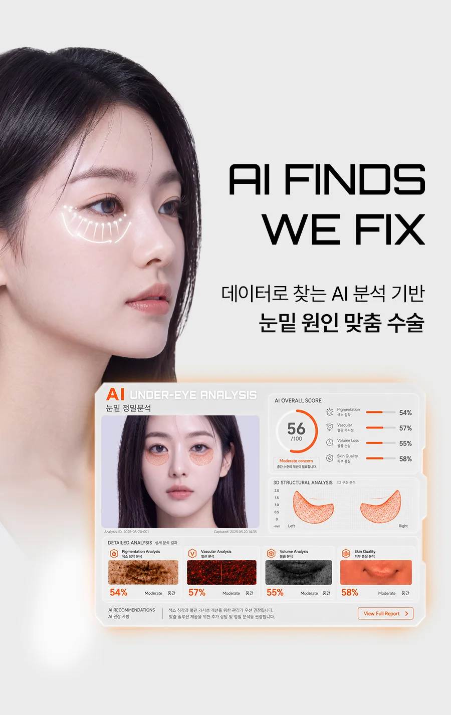 데이터로 찾는 AI 분석 기반 눈밑 원인 맞춤 수술 — AI FINDS. WE FIX. 눈밑 정밀분석 리포트(색소침착 54%, 혈관 가시성 57%, 볼륨 손실 55%, 피부 품질 58%)