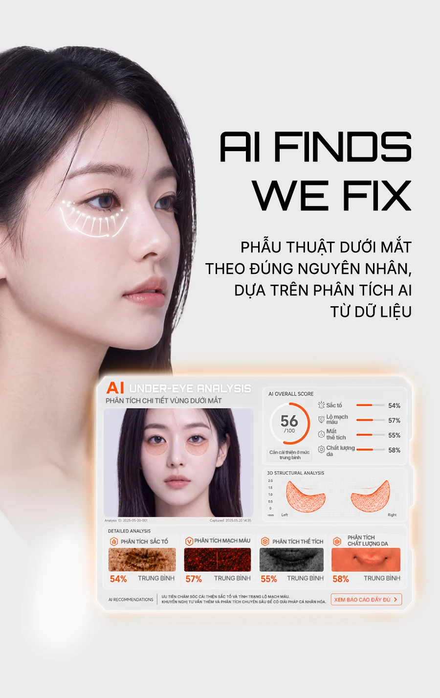 Phẫu thuật dưới mắt theo đúng nguyên nhân, dựa trên phân tích AI từ dữ liệu — AI FINDS. WE FIX. Báo cáo phân tích chính xác vùng dưới mắt (sắc tố 54%, mạch máu lộ 57%, mất thể tích 55%, chất lượng da 58%)