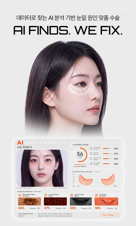 데이터로 찾는 AI 분석 기반 눈밑 원인 맞춤 수술 — AI FINDS. WE FIX. 눈밑 정밀분석 리포트(색소침착 54%, 혈관 가시성 57%, 볼륨 손실 55%, 피부 품질 58%)