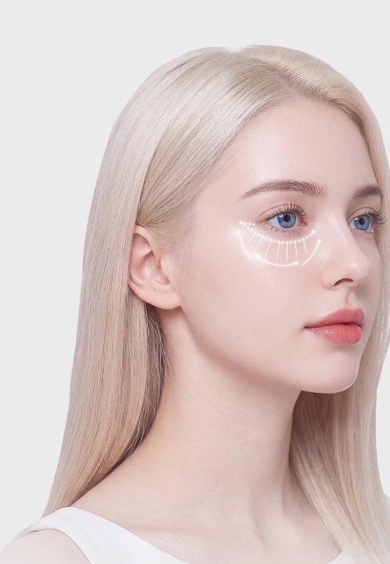 Model with under-eye analysis guidelines overlaid