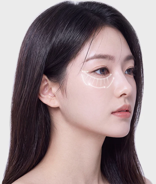 눈밑 정밀 분석 가이드라인이 표시된 모델