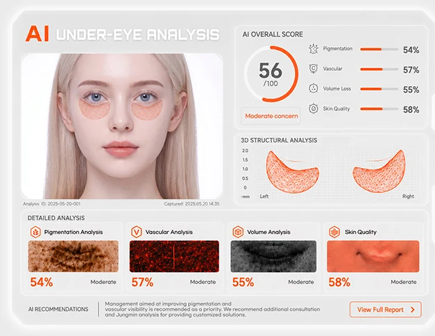 AI under-eye analysis report — scores for pigmentation, vascular, volume loss and skin quality, with 3D structural analysis