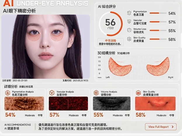 AI眼下精密分析报告 — 色素沉着·血管·容积流失·肌肤质感各项评分与3D结构分析