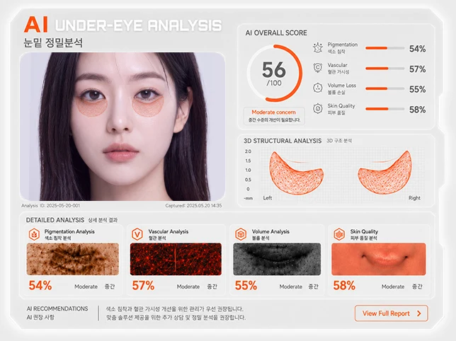 AI 눈밑 정밀분석 리포트 — 색소침착·혈관·볼륨 손실·피부결 항목별 점수와 3D 구조 분석