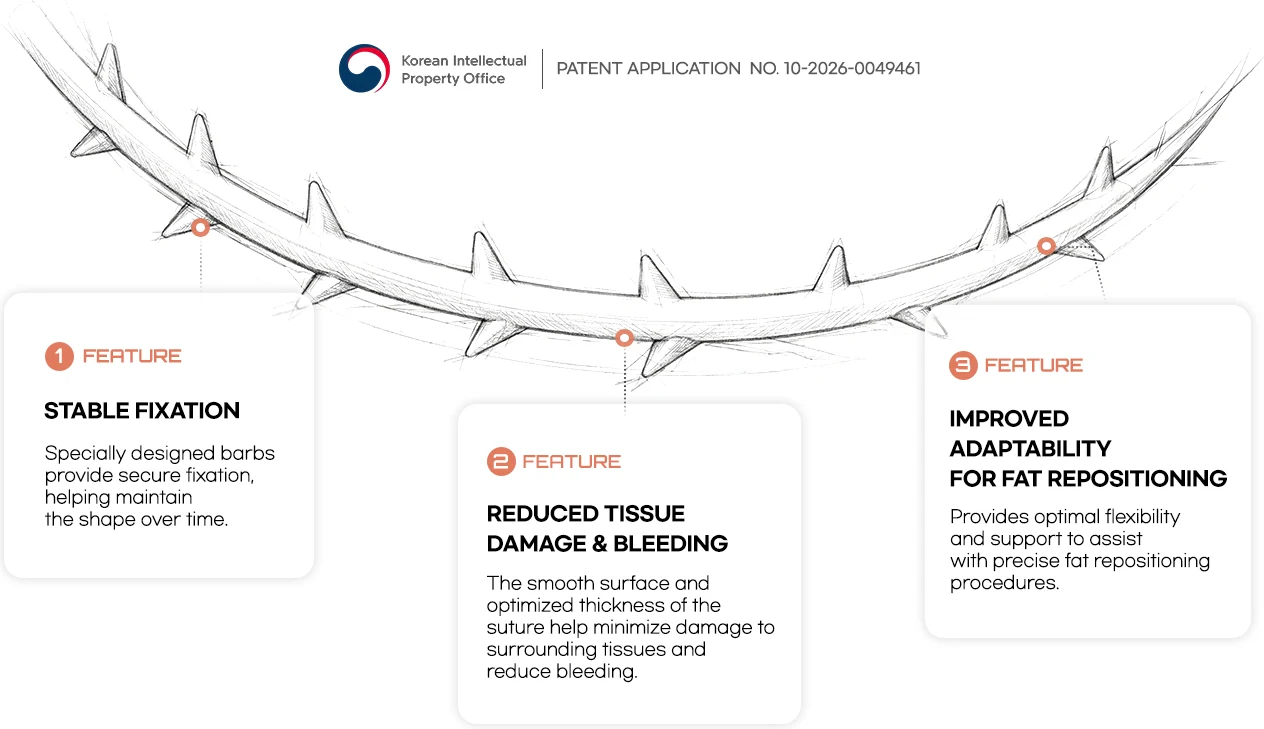 Under-eye suture — Patent Application No. 10-2026-0049461. FEATURE 1 Stable fixation: specially designed barbs anchor firmly in the tissue so the shape holds over time. FEATURE 2 Less tissue damage and bleeding: a smooth surface and optimized thickness minimize damage to surrounding tissue and bleeding. FEATURE 3 Optimized for orbital fat repositioning: balanced flexibility and support for precise procedures