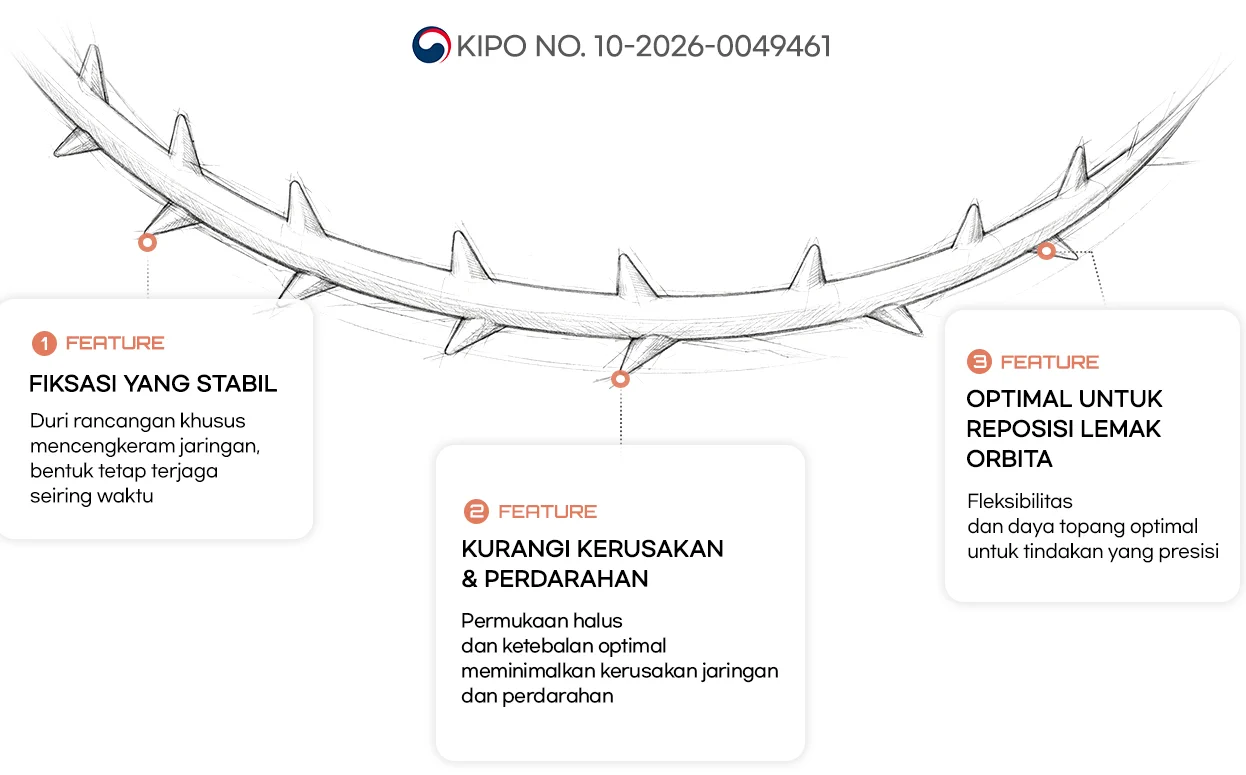 Benang khusus bawah mata — KIPO No. 10-2026-0049461. FEATURE 1 Fiksasi yang stabil: duri rancangan khusus mencengkeram jaringan sehingga bentuk tetap terjaga seiring waktu. FEATURE 2 Kurangi kerusakan jaringan & perdarahan: permukaan halus dan ketebalan optimal meminimalkan kerusakan jaringan sekitar dan perdarahan. FEATURE 3 Optimal untuk reposisi lemak orbita: fleksibilitas dan daya topang optimal mendukung tindakan yang presisi