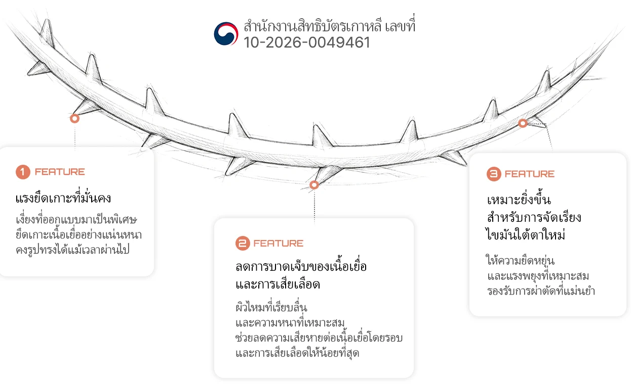 ไหมเย็บเฉพาะสำหรับใต้ตา — สำนักงานสิทธิบัตรเกาหลี เลขที่ 10-2026-0049461. FEATURE 1 แรงยึดเกาะที่มั่นคง: เงี่ยงที่ออกแบบมาเป็นพิเศษยึดเกาะเนื้อเยื่ออย่างแน่นหนา คงรูปทรงได้แม้เวลาผ่านไป. FEATURE 2 ลดการบาดเจ็บของเนื้อเยื่อและการเสียเลือด: ผิวไหมที่เรียบลื่นและความหนาที่เหมาะสม ช่วยลดความเสียหายต่อเนื้อเยื่อโดยรอบและการเสียเลือดให้น้อยที่สุด. FEATURE 3 เหมาะยิ่งขึ้นสำหรับการจัดเรียงไขมันใต้เบ้าตาใหม่: ให้ความยืดหยุ่นและแรงพยุงที่เหมาะสม รองรับการผ่าตัดที่แม่นยำ