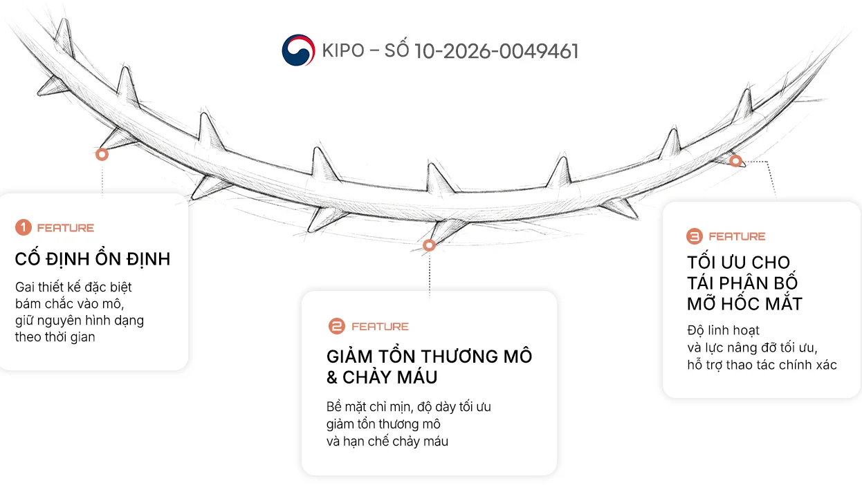 Chỉ chuyên dụng vùng dưới mắt — KIPO số 10-2026-0049461. FEATURE 1 Cố định ổn định: gai thiết kế đặc biệt bám chắc vào mô, giữ nguyên hình dạng theo thời gian. FEATURE 2 Giảm tổn thương mô & chảy máu: bề mặt chỉ mịn và độ dày tối ưu giảm tổn thương mô xung quanh và hạn chế chảy máu. FEATURE 3 Tối ưu cho tái phân bố mỡ hốc mắt: độ linh hoạt và lực nâng đỡ tối ưu hỗ trợ thao tác chính xác