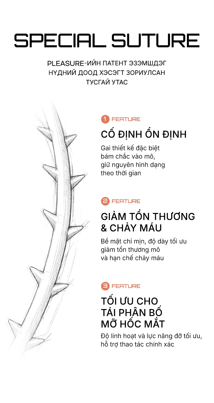 Chỉ dưới mắt độc quyền PLEASURE đang đăng ký sáng chế SPECIAL SUTURE — FEATURE 1 Cố định ổn định: gai thiết kế đặc biệt giữ nguyên hình dạng theo thời gian / FEATURE 2 Giảm tổn thương mô & chảy máu: bề mặt mịn và độ dày tối ưu giảm tổn thương và chảy máu / FEATURE 3 Tối ưu cho tái phân bố mỡ hốc mắt: độ linh hoạt và lực nâng đỡ tối ưu hỗ trợ thao tác chính xác